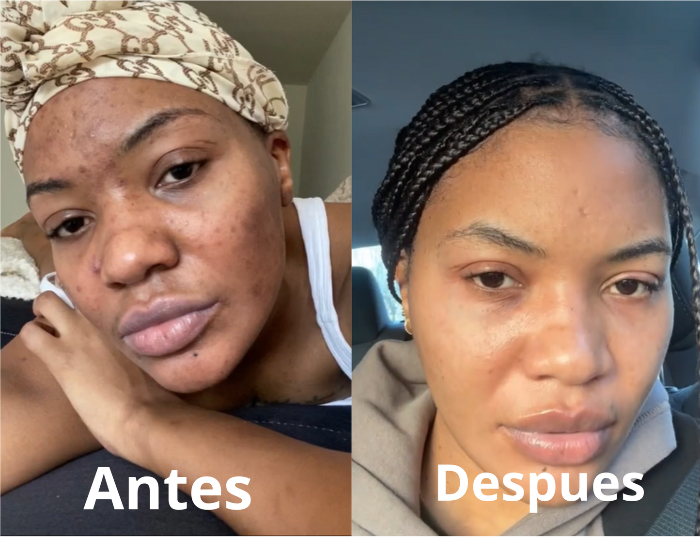 serum de vitamina C Suero Facial Ácido Hialurónico Hidratante Reparación Piel Restaura Hidratación