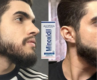 Tratamiento capilar para una barba Varonil