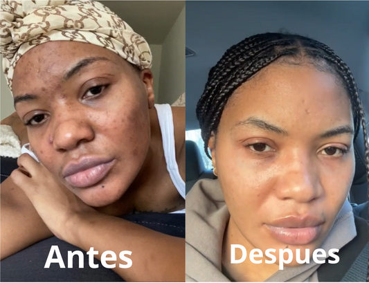 serum de vitamina C Suero Facial Ácido Hialurónico Hidratante Reparación Piel Restaura Hidratación